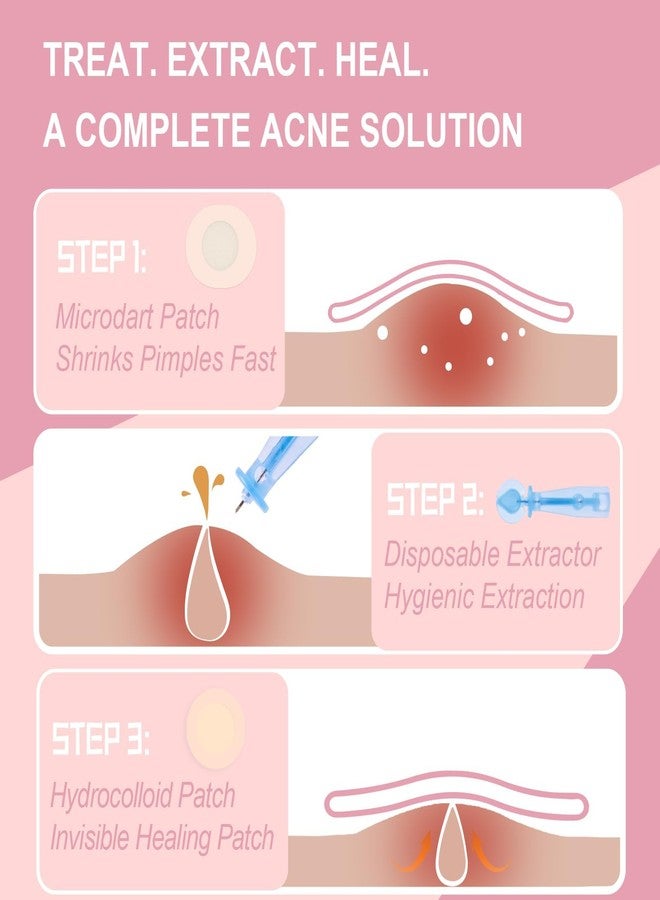 Vathery Pimple Patches Set with Microdart Pimples Patche and Hydrocolloid Patch – 3-Step Acne Kit for Fast Blemish Removal, Blackhead Extractor Tools, Zit Patches for Face - Image 2